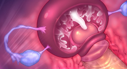Crash the CERVIX !